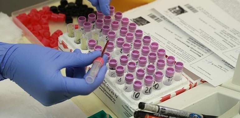 За минувшие сутки в области зарегистрировано 104 новых случая заражения коронавирусной инфекцией