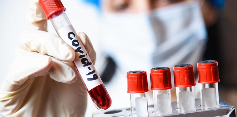 За минувшие сутки в области зарегистрировано еще 85 новых случаев заражения коронавирусной инфекцией