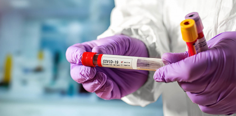 За минувшие сутки в области зарегистрировано 75 новых случаев заражения коронавирусной инфекцией