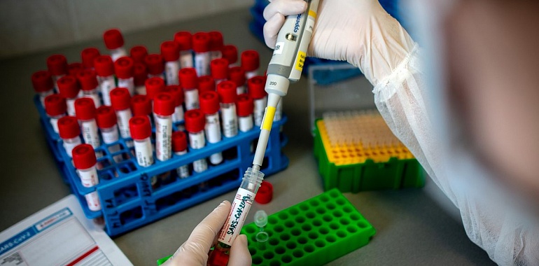 За сутки в Тульской области зарегистрировано 86 новых случаев заражения коронавирусной инфекцией