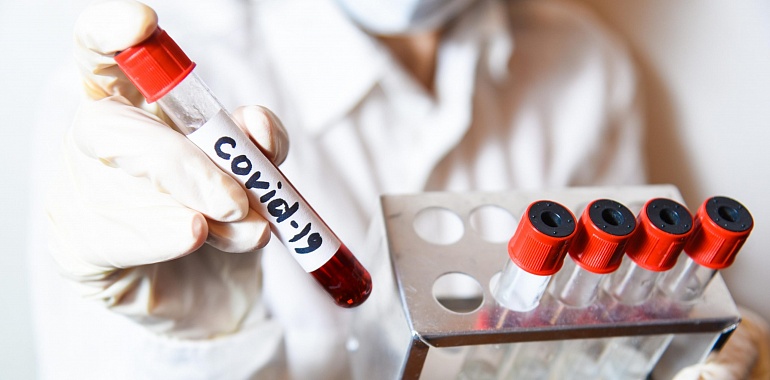 В Тульской области за сутки зарегистрированы рекордные 98 новых случаев заражения коронавирусной инфекцией